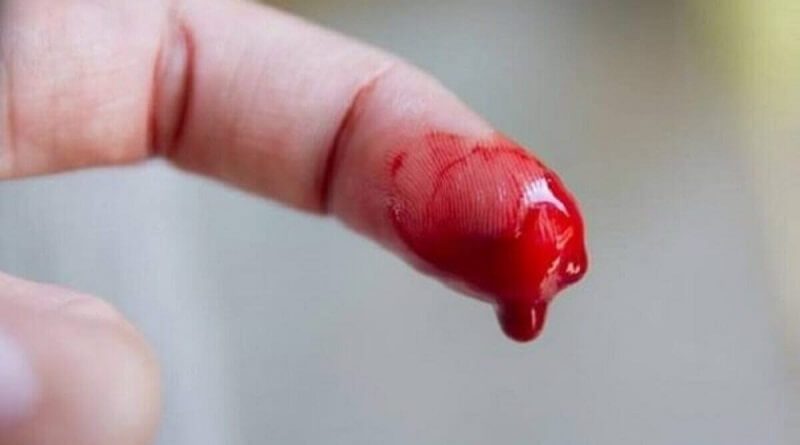 Nằm mơ thấy đứt tay chảy máu là điềm gì? Đánh số mấy dễ ăn?