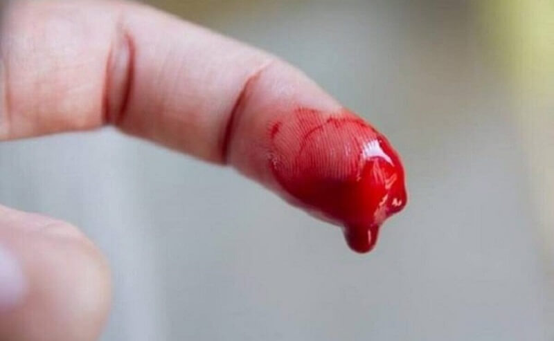 Giải mã ý nghĩa khi nằm mơ thấy đứt tay chảy máu
